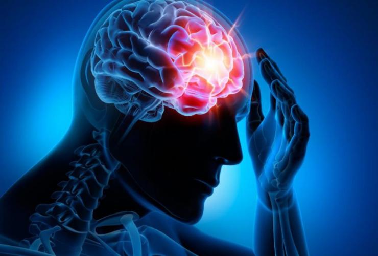 Epilepsija – ką svarbu žinoti kiekvienam