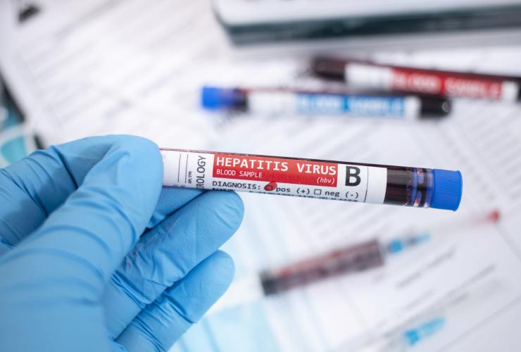 Planuojate kelionę? Nepamirškite pasirūpinti savo sveikata – pasiskiepykite nuo hepatito A ir B!
