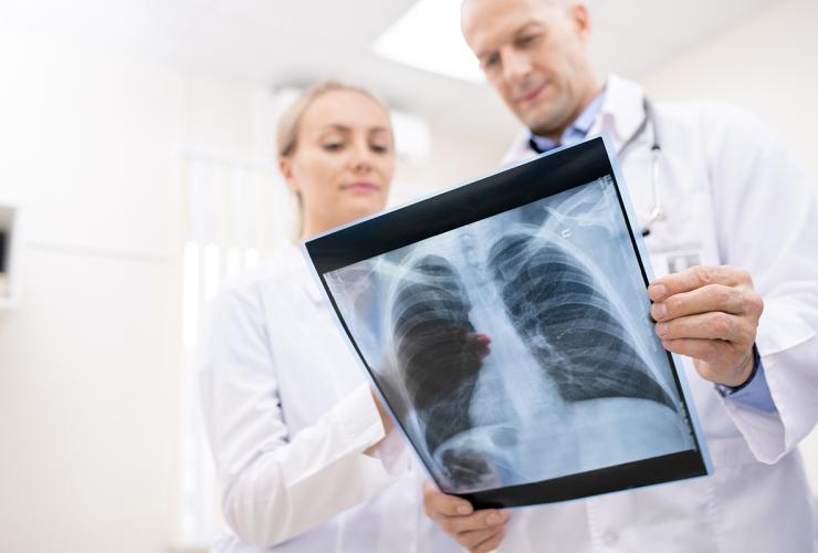 Rentgeno tyrimas su siuntimu – tą pačią dieną Karoliniškių poliklinikoje