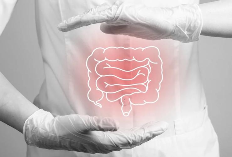 Pasitikrinkite laiku: storosios žarnos vėžio prevencija gali išgelbėti gyvybę